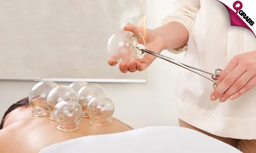 Cupping & More!   